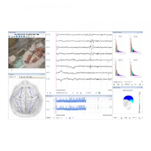 EB Neuro GALILEO SUITE SOFTWARE